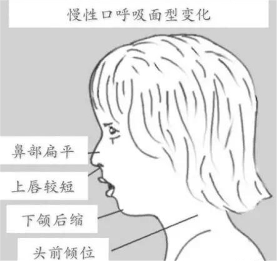 长沙口呼吸