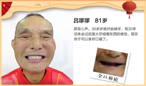 新年（链接页-移动）_24.jpg