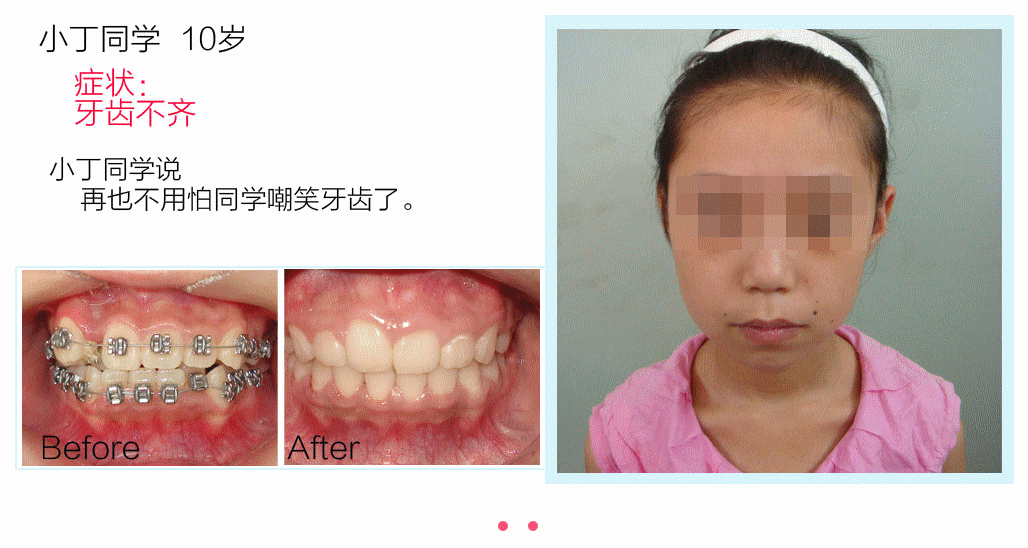 牙齿矫正,种植牙,牙齿美容,口腔医院,牙大夫-专注10年