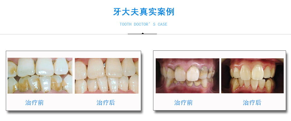 牙大夫真实案例.jpg