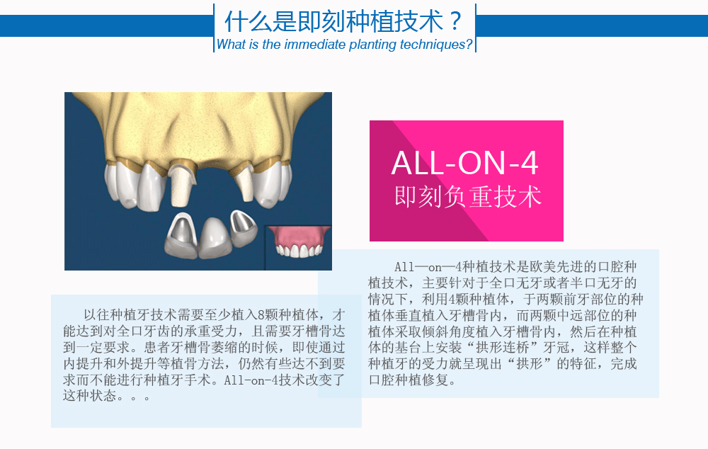 即刻种植牙总_02.gif