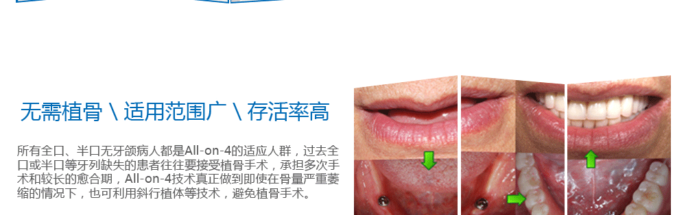 即刻种植牙总_05.gif