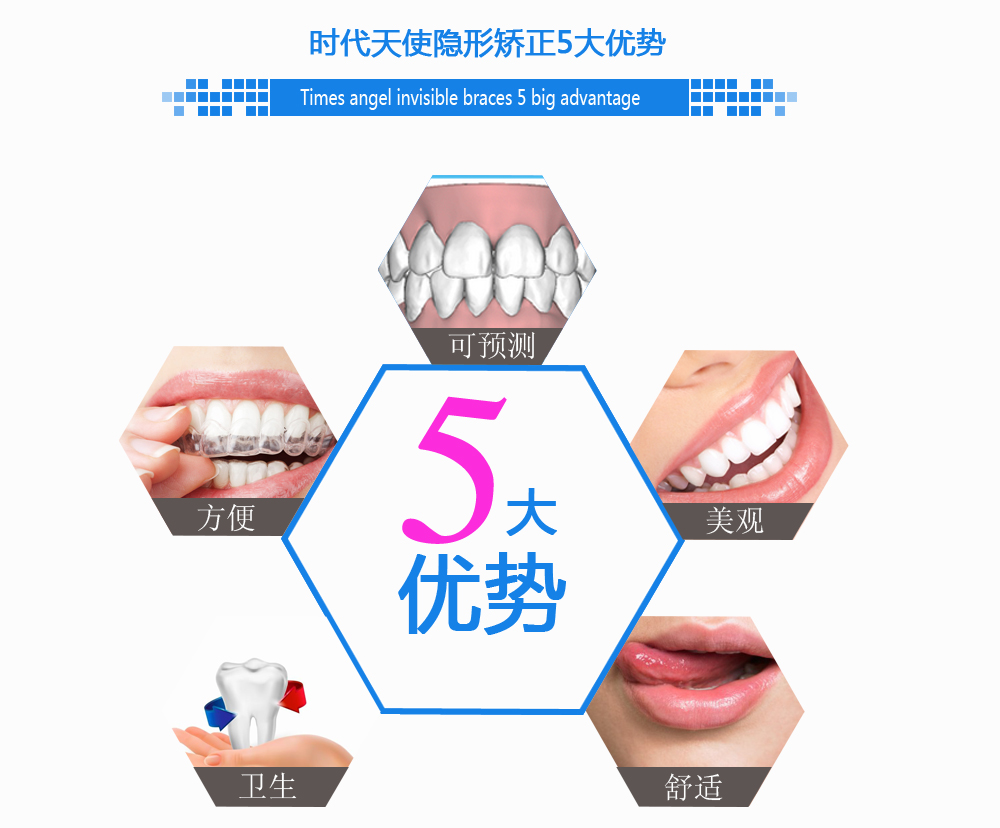 时代天使5大优势.jpg