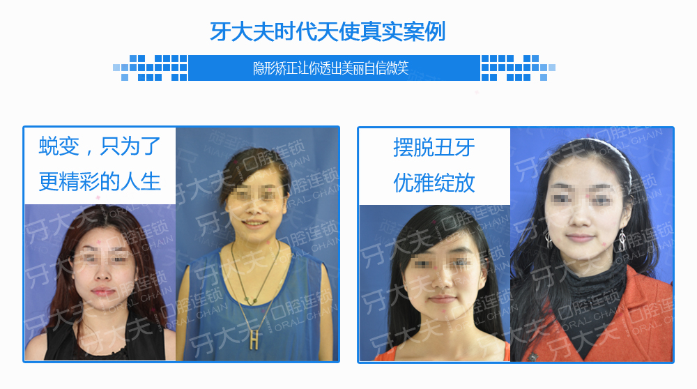 时代天使案例.jpg