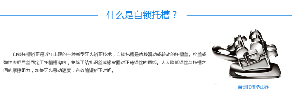 自锁托槽矫正_01.png