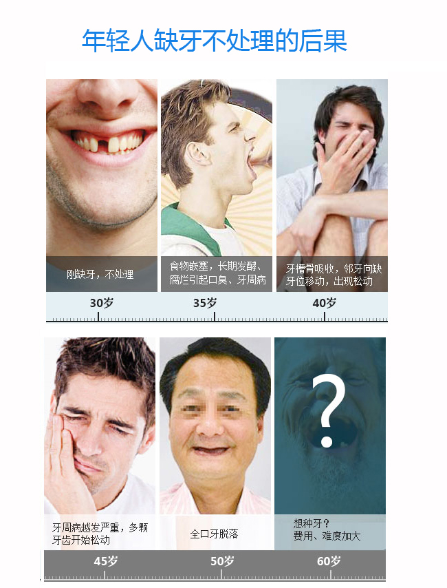 年轻人缺牙不处理的后果.jpg