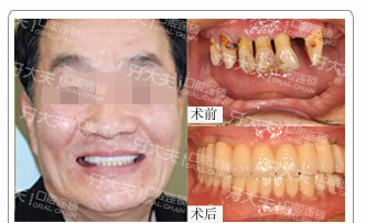 牙齿矫正页面_23.png