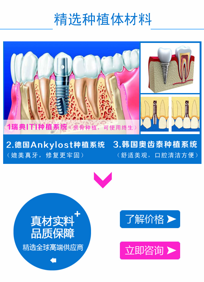 精选种植体材料.jpg