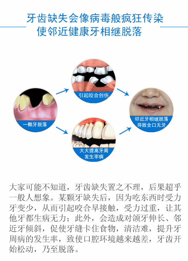 牙齿脱落会影响周围的牙齿.jpg