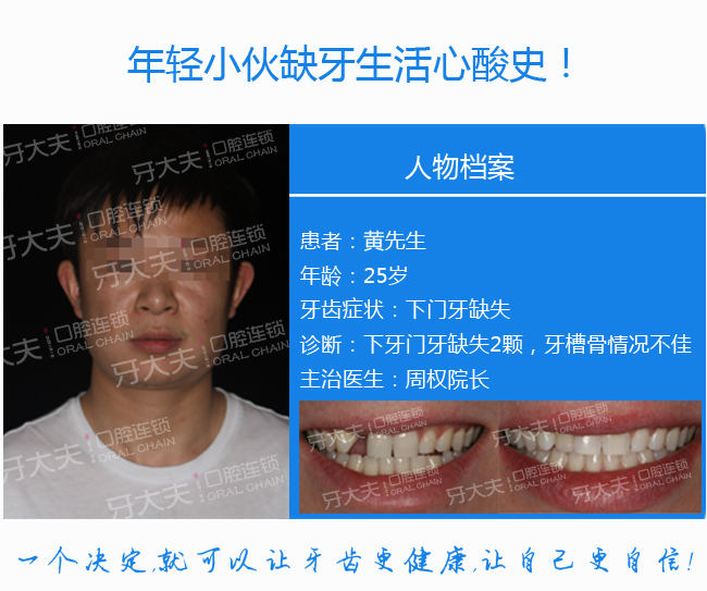缺牙生活辛酸史.jpg