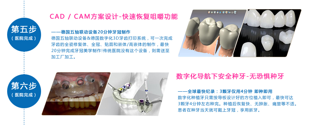 数字化种植牙_05.png