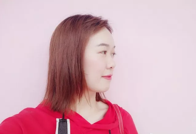 牙齿矫正后照片 牙齿矫正后照片