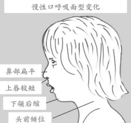 长沙口呼吸