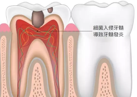 牙齿问题