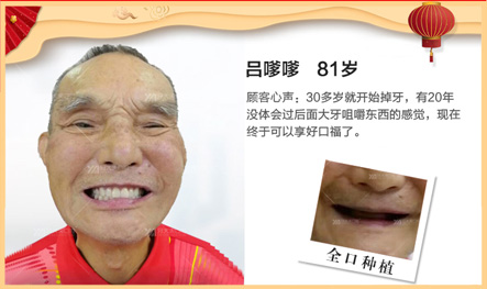 新年（链接页-移动）_24.jpg