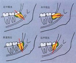 115-1602011J15G47.jpg