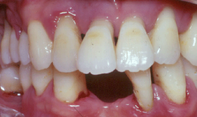 107-1Q219114011A6.png